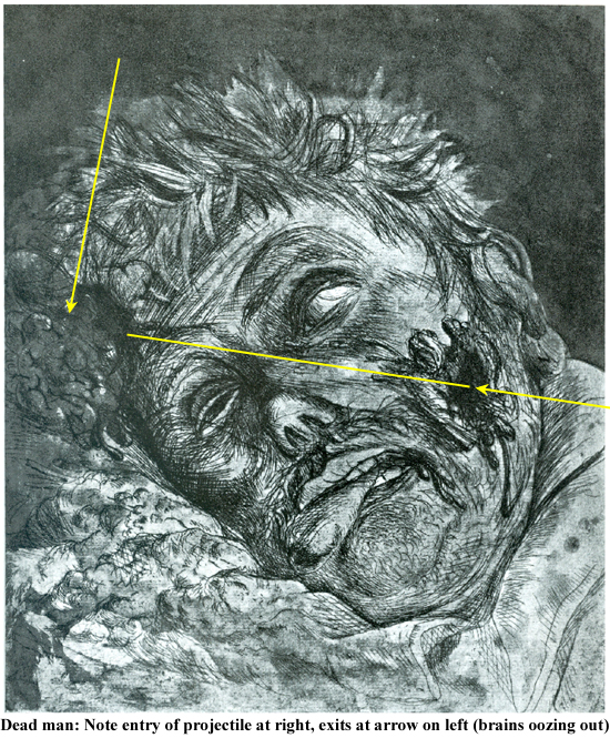 Dead man (brains oozing) Otto Dix 42